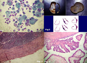 Papanicolau, macroscopa y HE