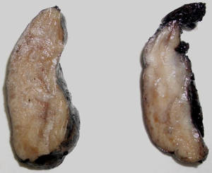 Macroscopía